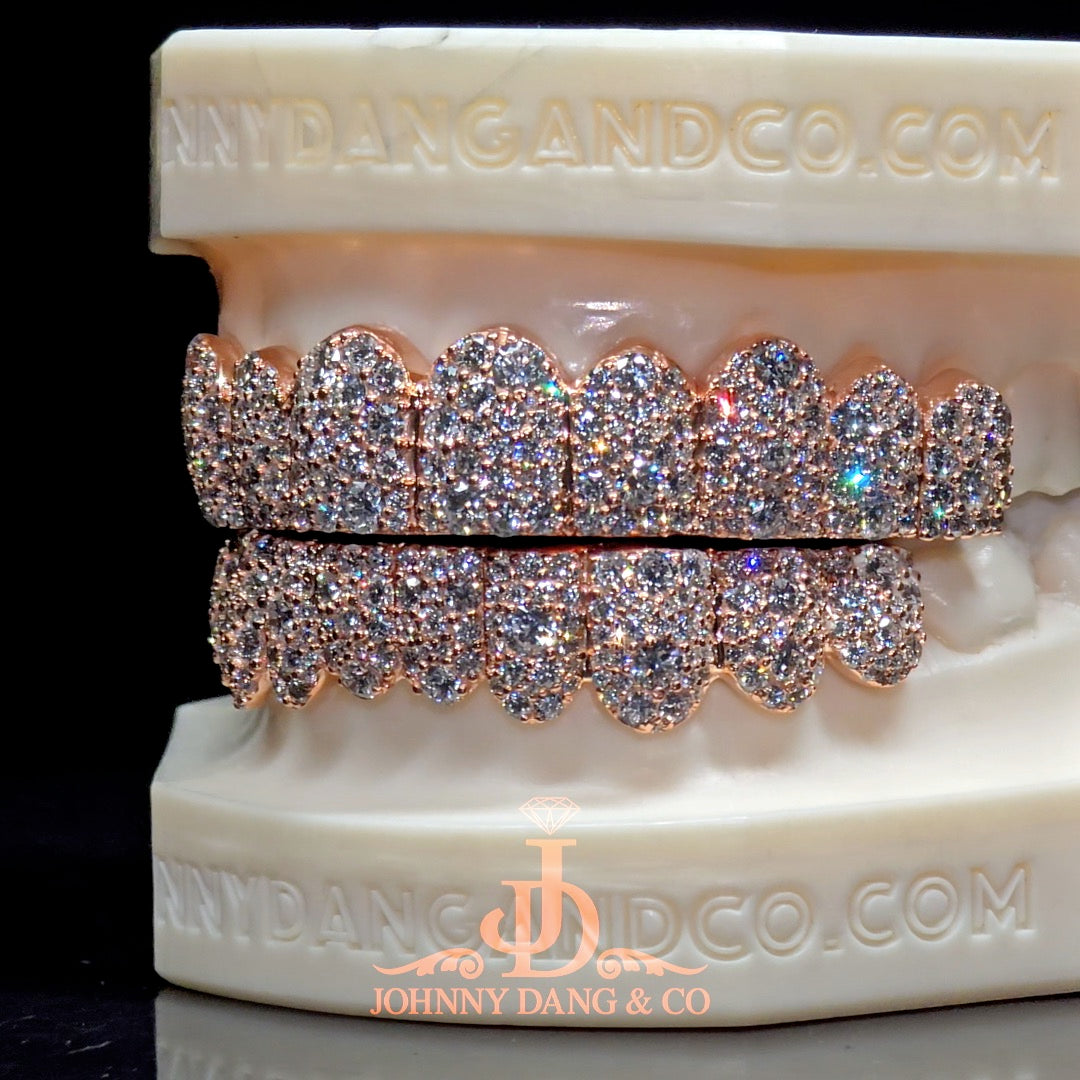 Flawless Mosaic Set Grillz Rose Gold (Pull Out) ✅