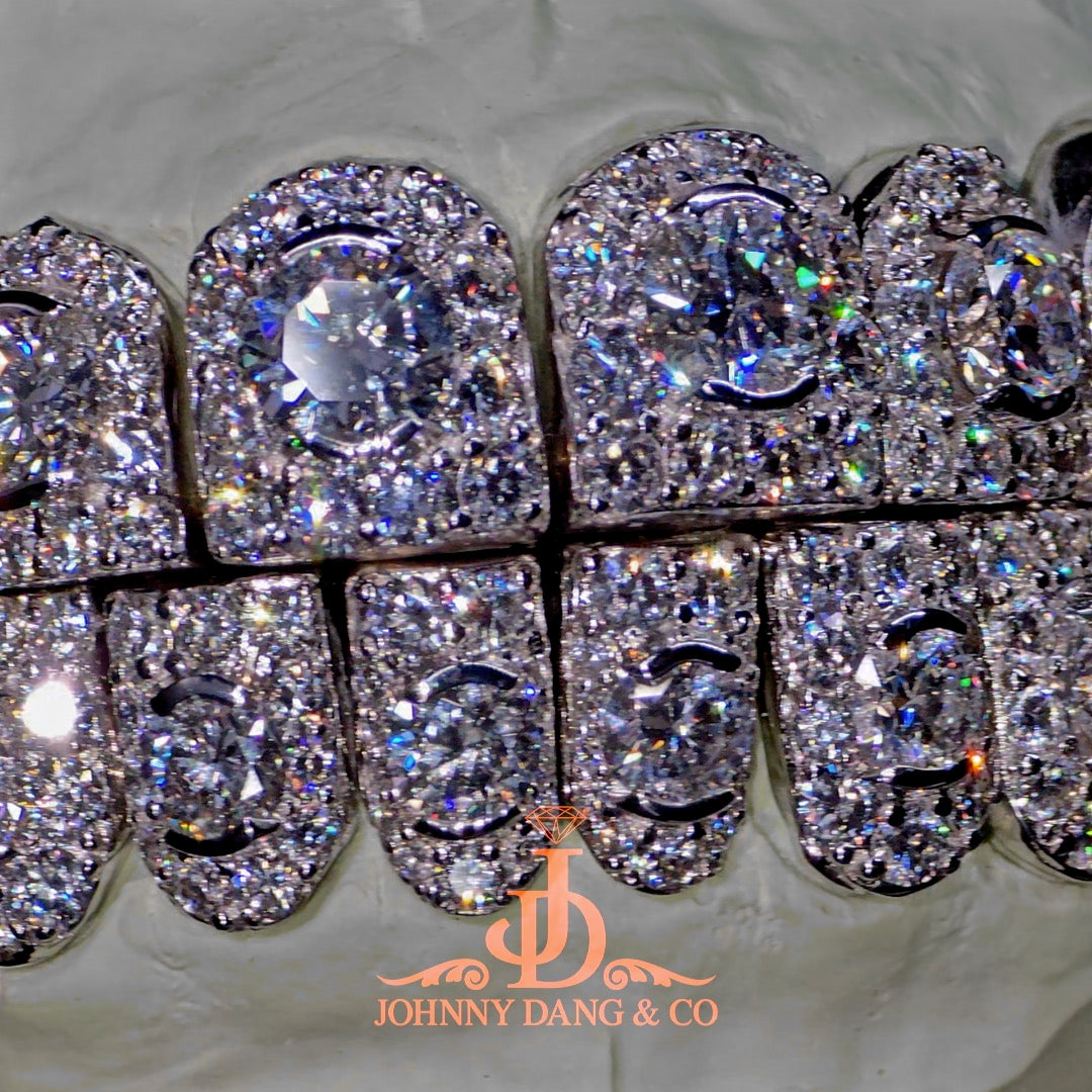 GIA "Honeymoon" Set Grillz White Gold (Perms)