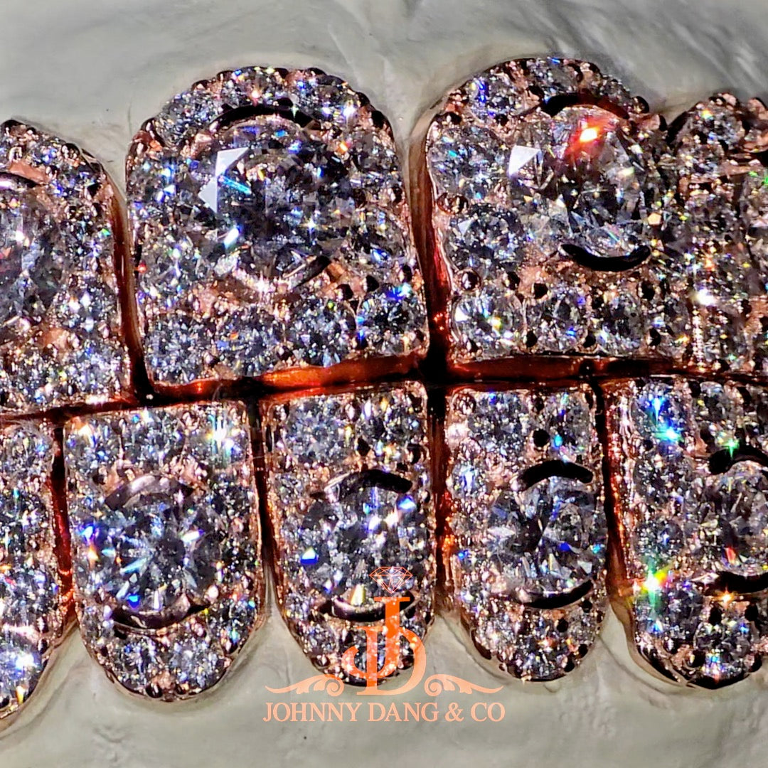 GIA "Honeymoon" Set Grillz Rose Gold (Perms) ✅