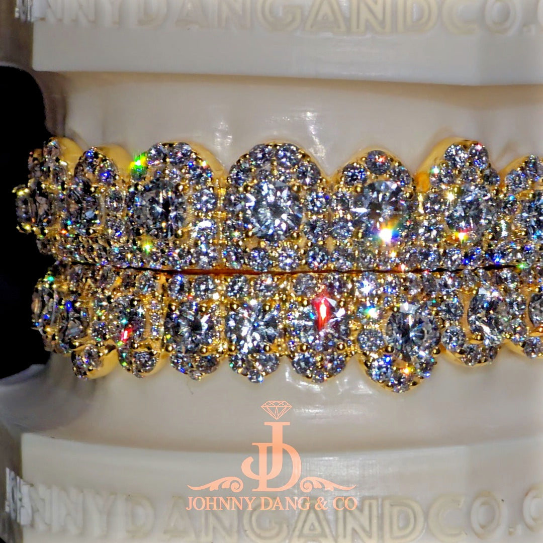 GIA "Honeymoon" Set Grillz Yellow Gold (Pull Out) ✅