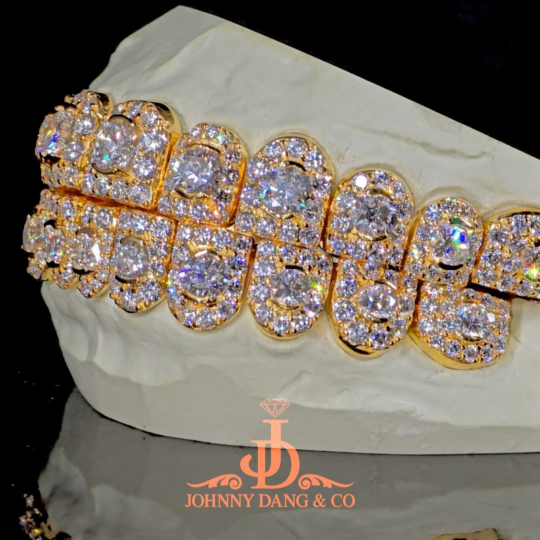 GIA "Honeymoon" Set Grillz Yellow Gold (Perms) ✅