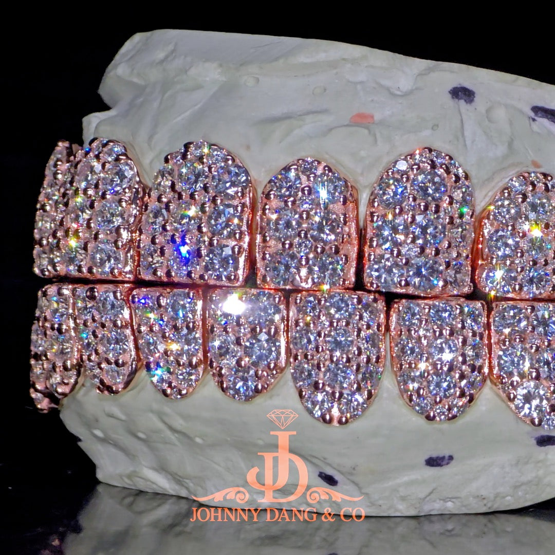 Flawless "10pt Ghost" Set Grillz Rose Gold (Perms) ✅