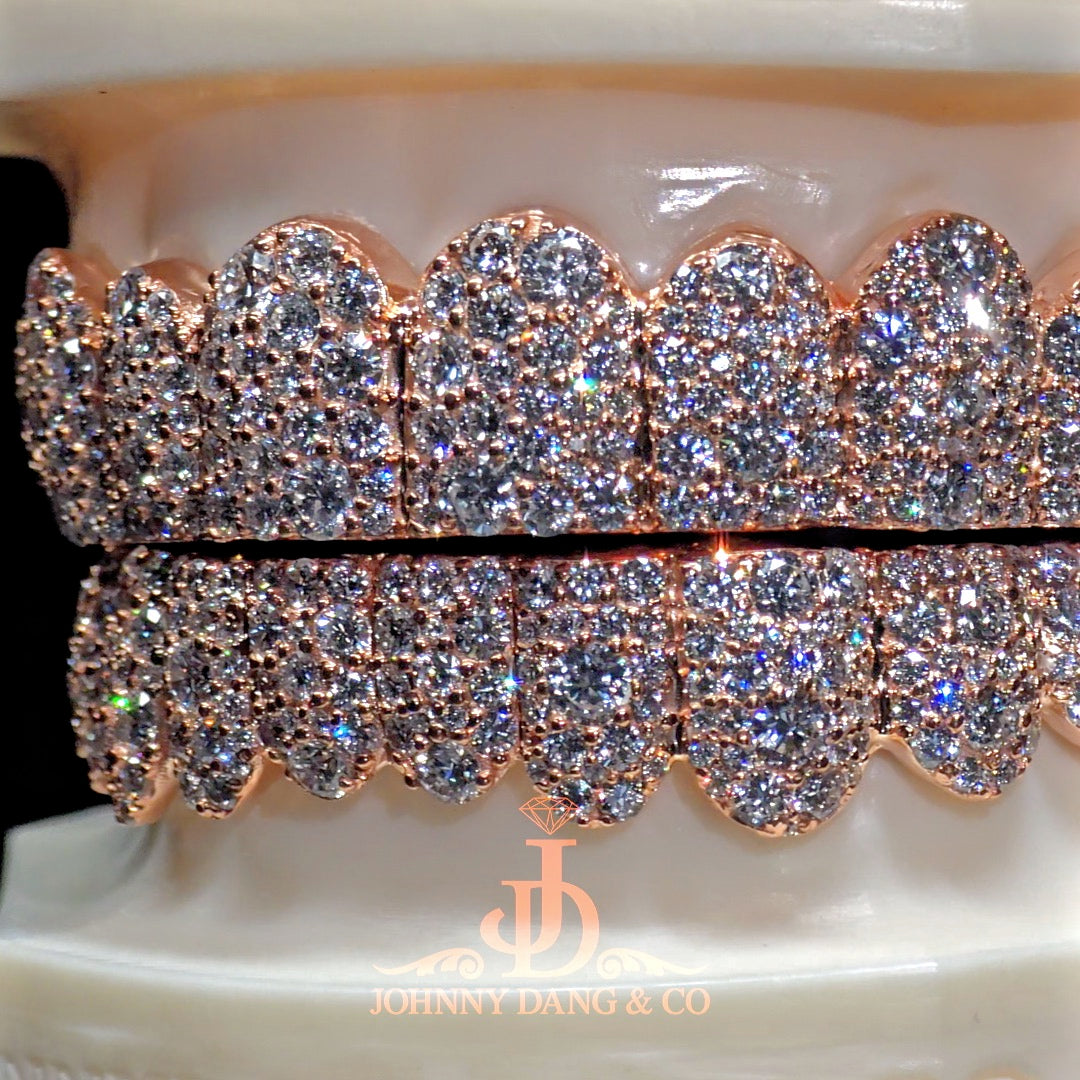 Flawless Mosaic Set Grillz Rose Gold (Pull Out) ✅