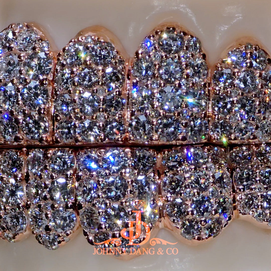Flawless "10pt Ghost" Set Grillz Rose Gold (Pullout) ✅
