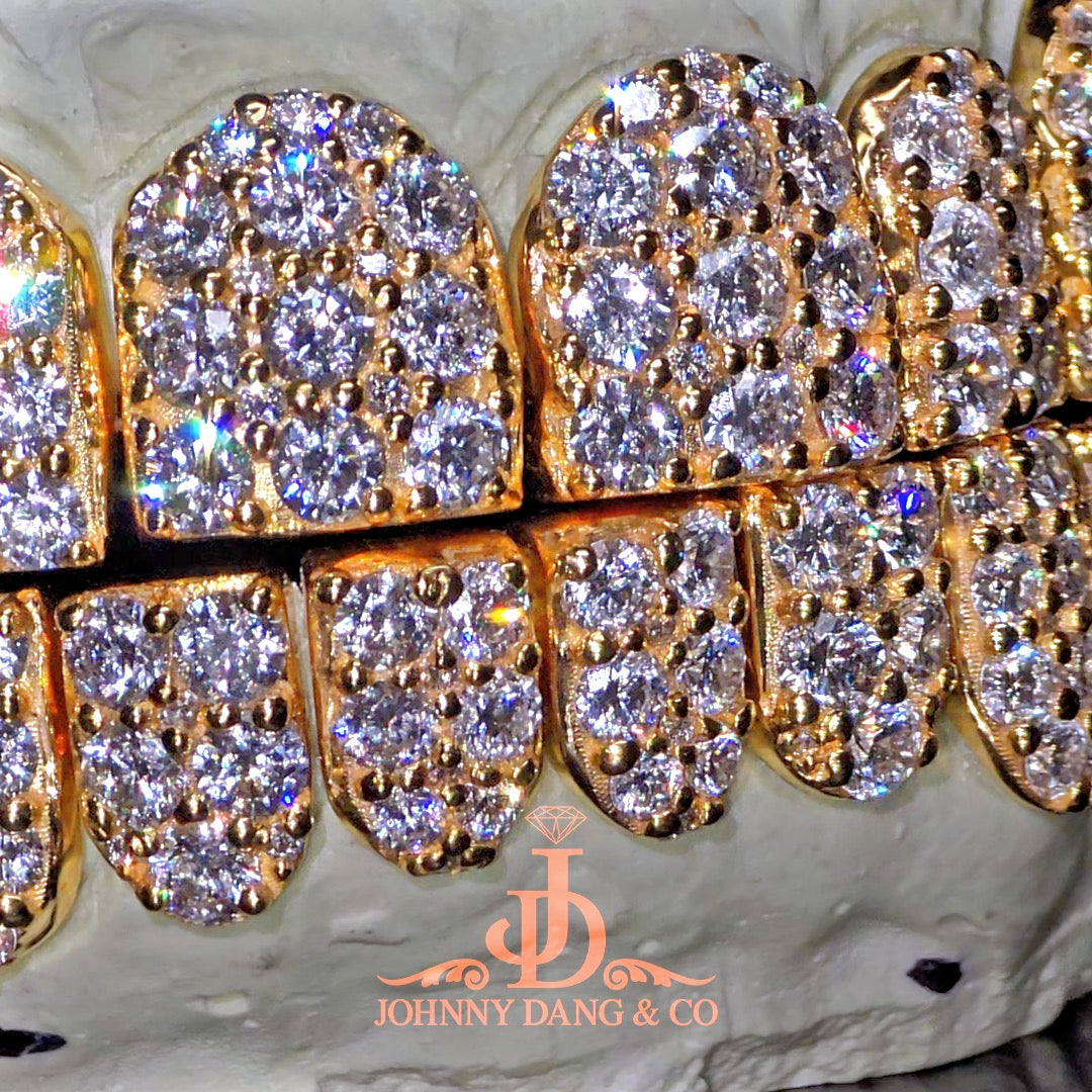 Flawless "10pt Ghost" Set Grillz Yellow Gold (Perms) ✅
