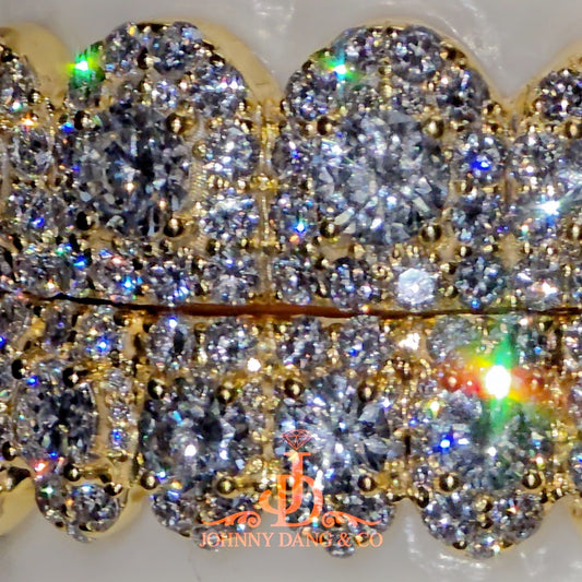 GIA "Honeymoon" Set Grillz Yellow Gold (Pull Out) ✅