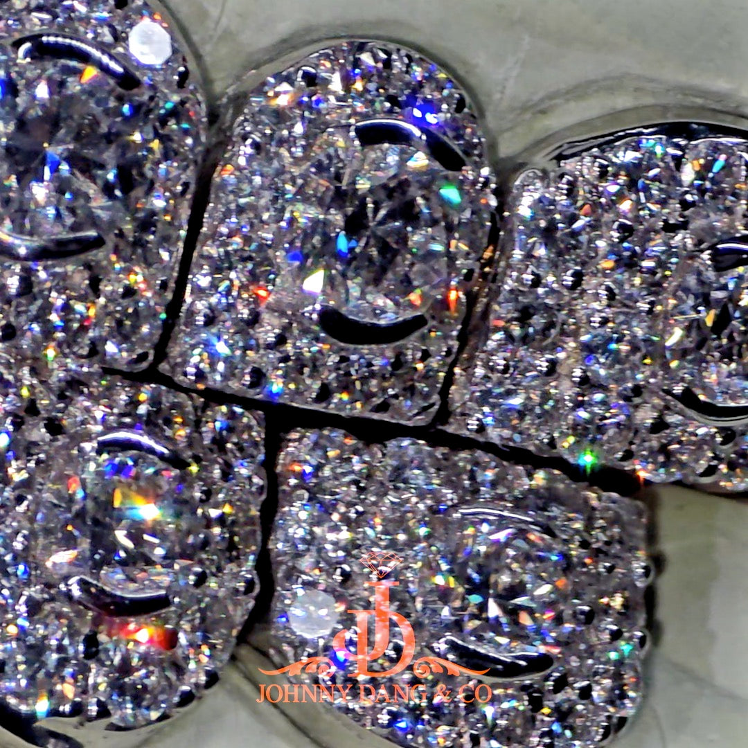 GIA "Honeymoon" Set Grillz White Gold (Perms)