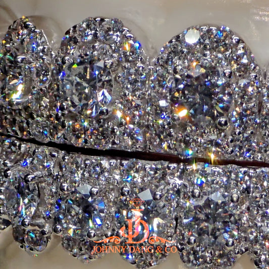 GIA "Honeymoon" Set Grillz White Gold (Pull Out)