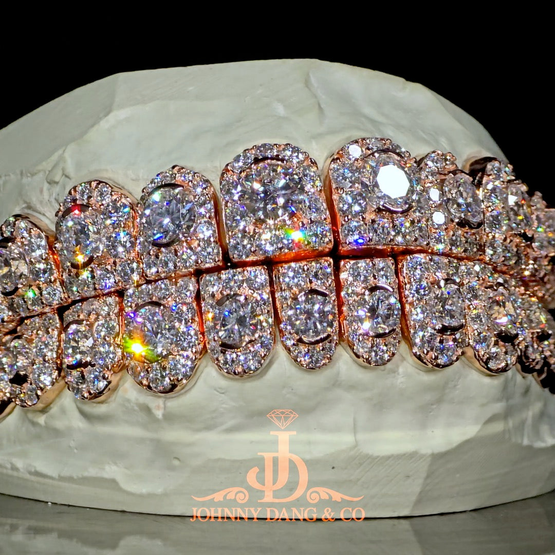 GIA "Honeymoon" Set Grillz Rose Gold (Perms) ✅
