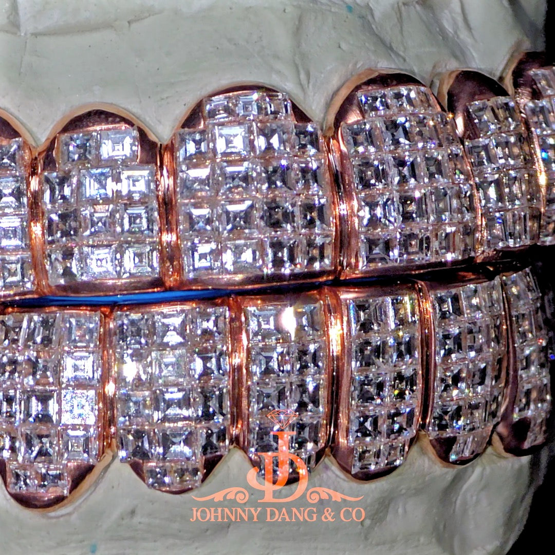 Flawless "King Carre Cut" Invisible Set Grillz Rose Gold (Pullout) ✅