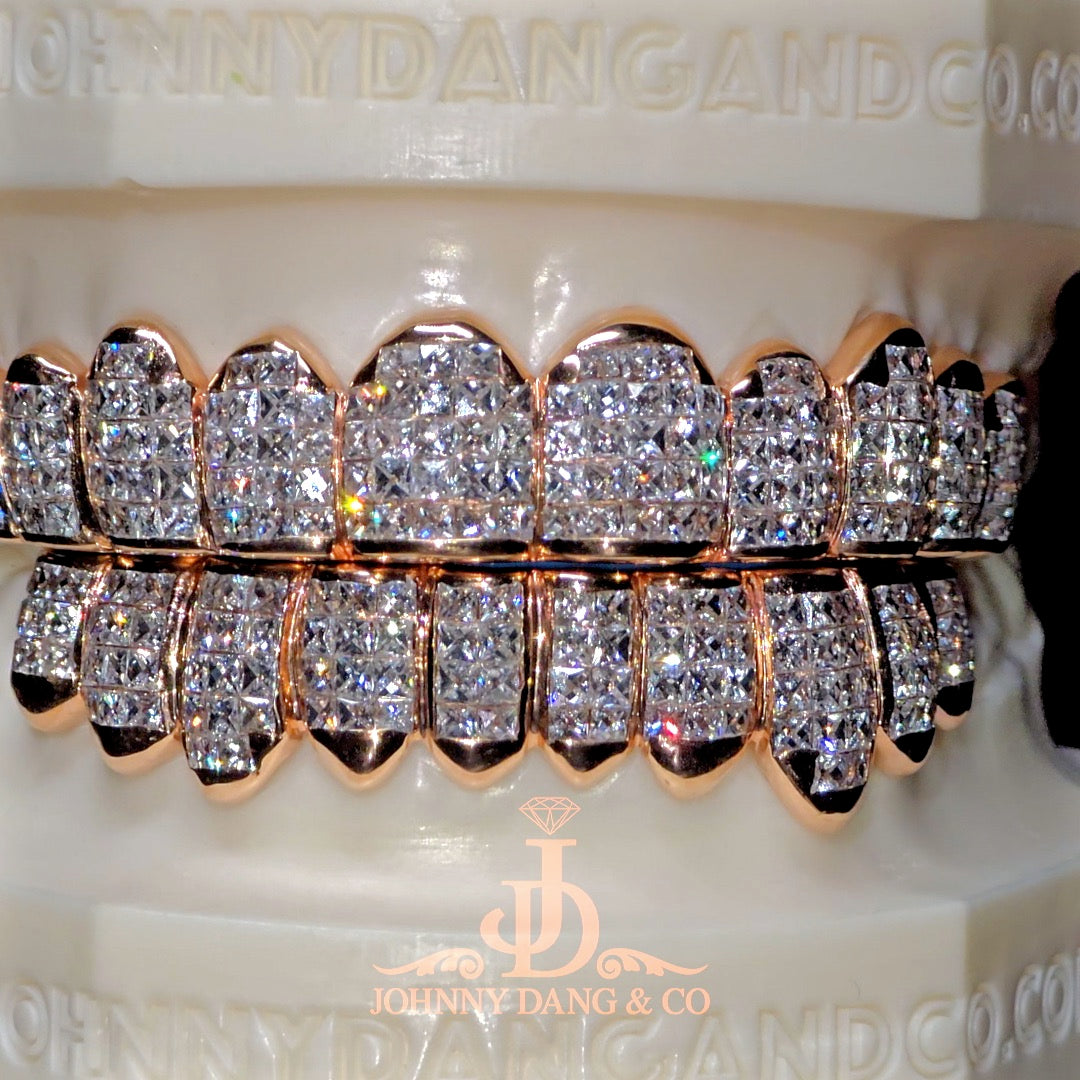 Flawless "French Cut" Invisible Set Grillz Rose Gold (Pullout) ✅