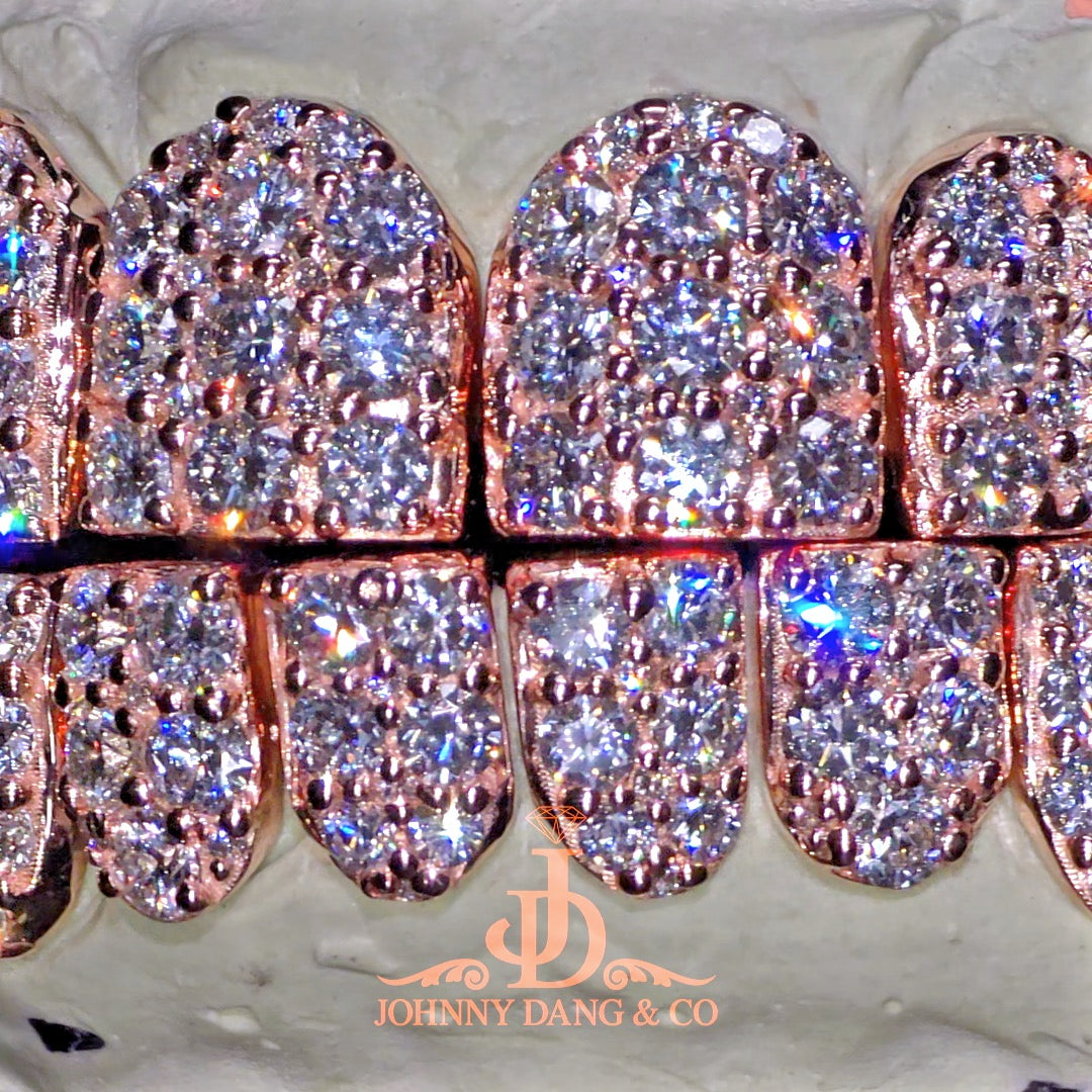 Flawless "10pt Ghost" Set Grillz Rose Gold (Perms) ✅