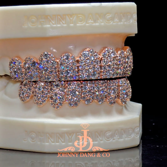 Flawless Mosaic Set Grillz Rose Gold (Pull Out) ✅