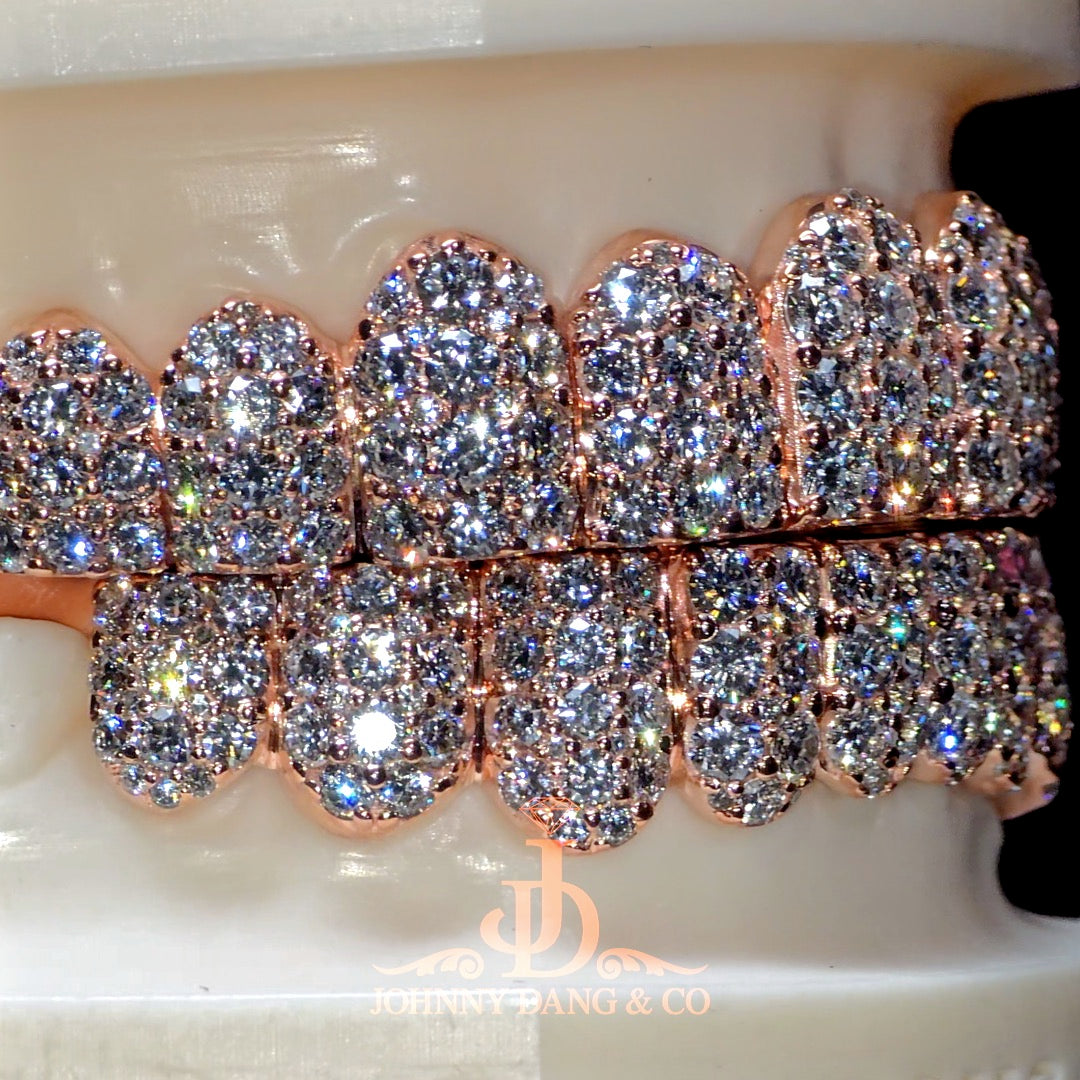Flawless "10pt Ghost" Set Grillz Rose Gold (Pullout) ✅