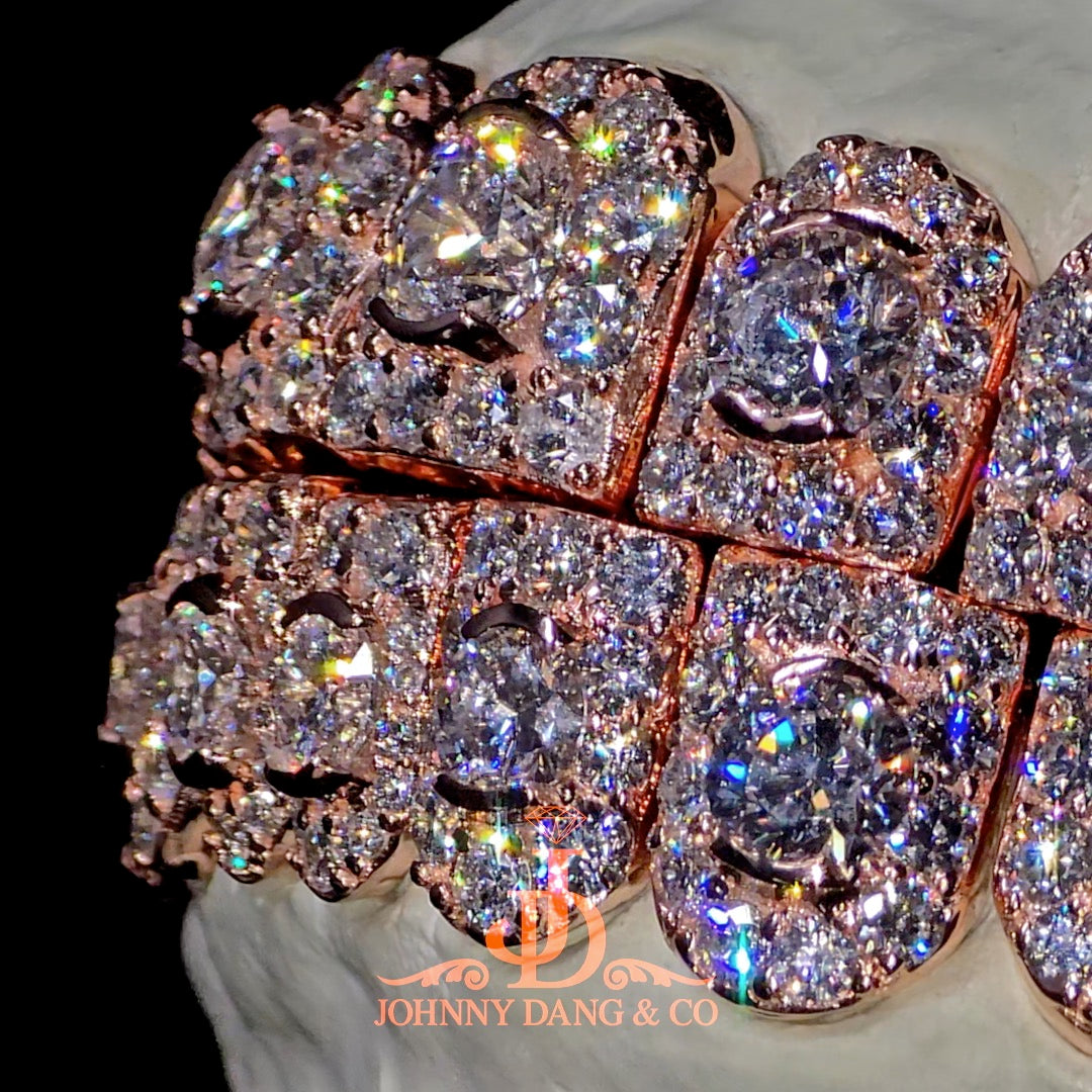 GIA "Honeymoon" Set Grillz Rose Gold (Perms) ✅