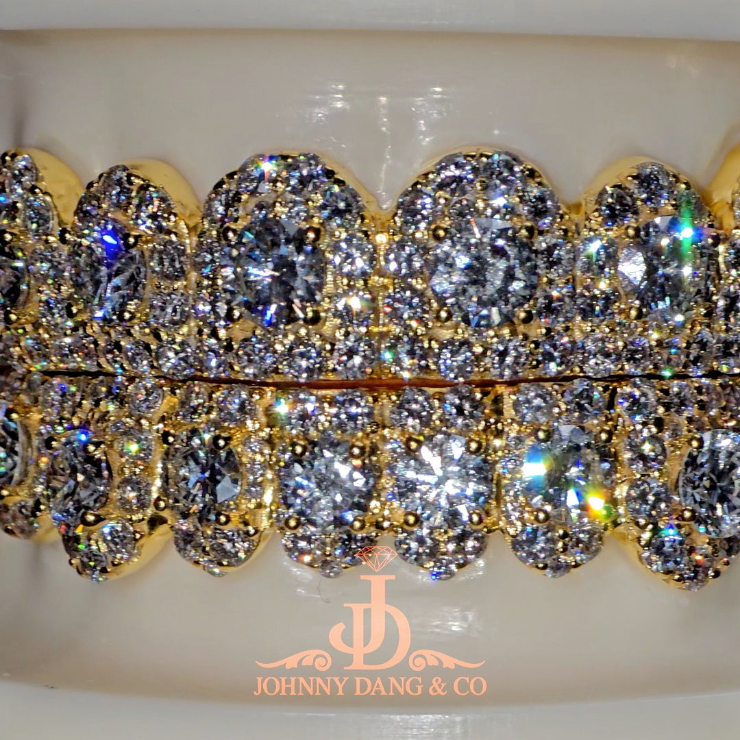 GIA "Honeymoon" Set Grillz Yellow Gold (Pull Out) ✅