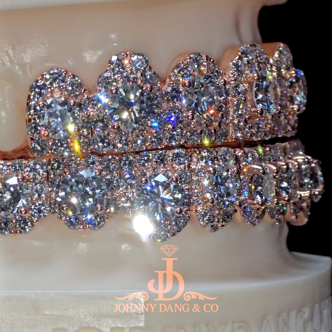 GIA "Honeymoon" Set Grillz Rose Gold (Pull Out) ✅