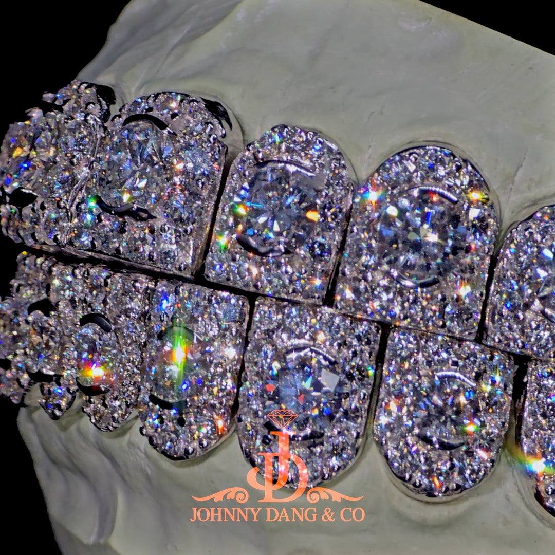 GIA "Honeymoon" Set Grillz White Gold (Perms)