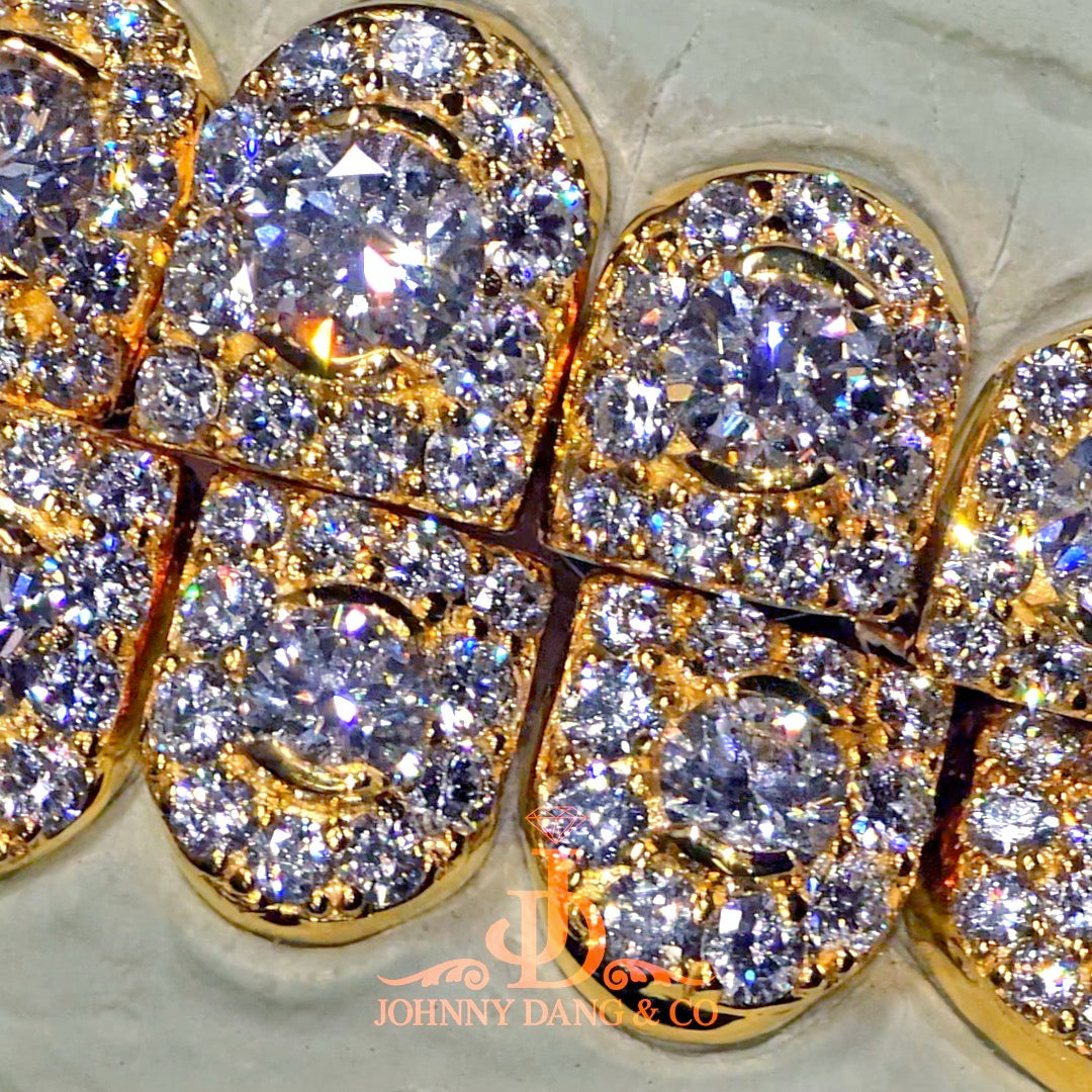 GIA "Honeymoon" Set Grillz Yellow Gold (Perms) ✅