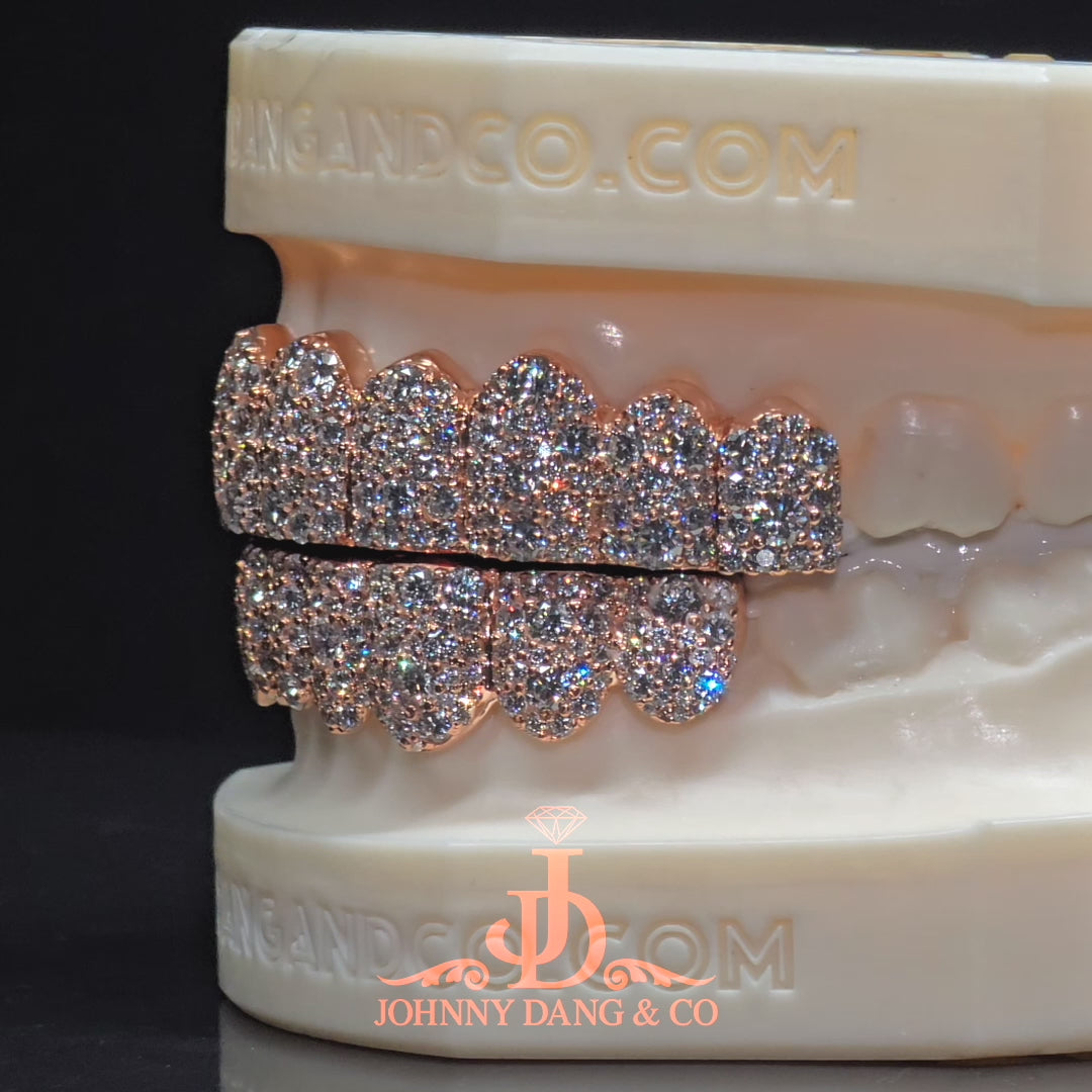 Flawless Mosaic Set Grillz Rose Gold (Pull Out) ✅