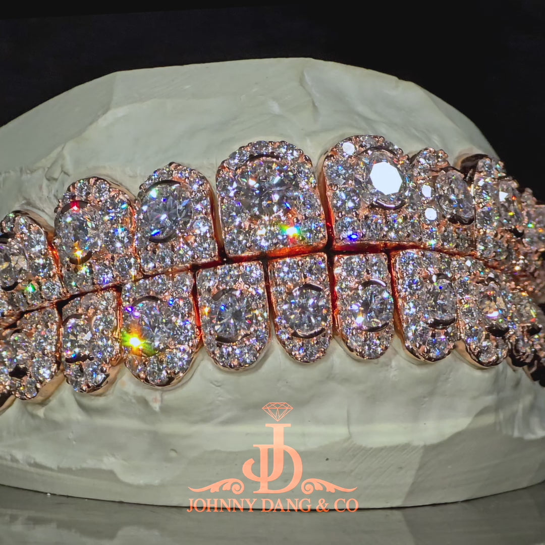 GIA "Honeymoon" Set Grillz Rose Gold (Perms) ✅
