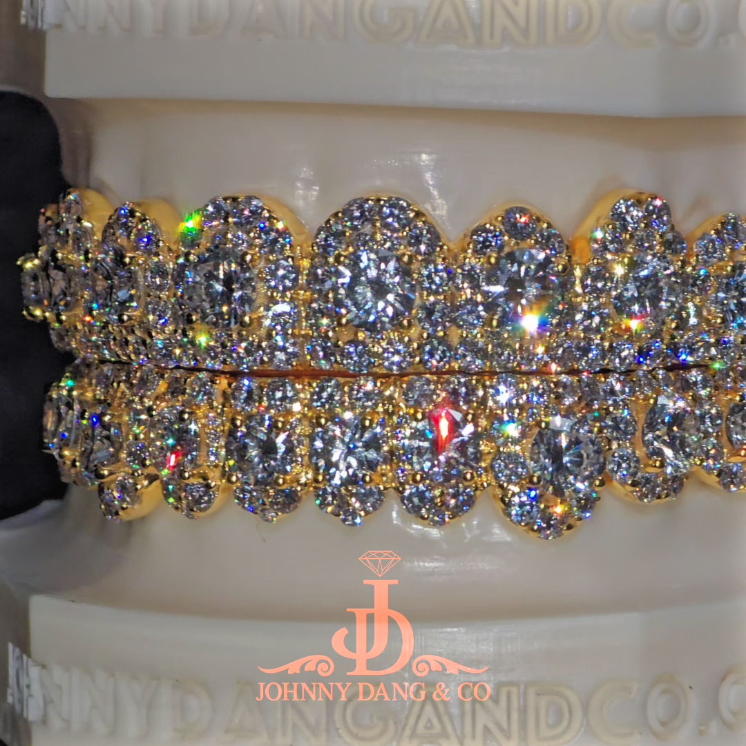 GIA "Honeymoon" Set Grillz Yellow Gold (Pull Out) ✅
