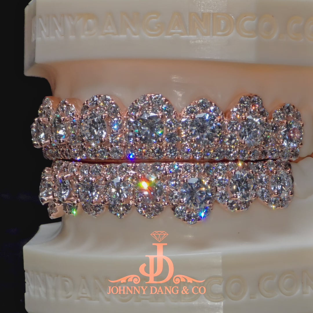 GIA "Honeymoon" Set Grillz Rose Gold (Pull Out) ✅