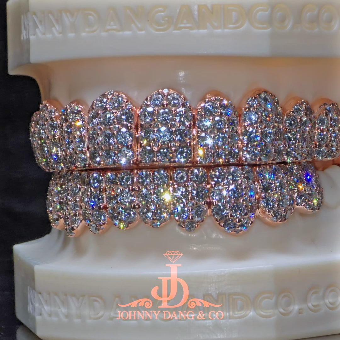 Flawless "10pt Ghost" Set Grillz Rose Gold (Pullout) ✅