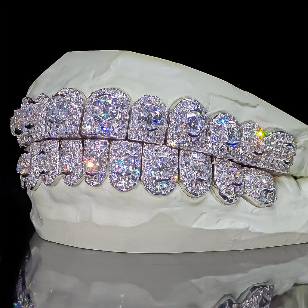 GIA "Honeymoon" Set Grillz White Gold (Perms)