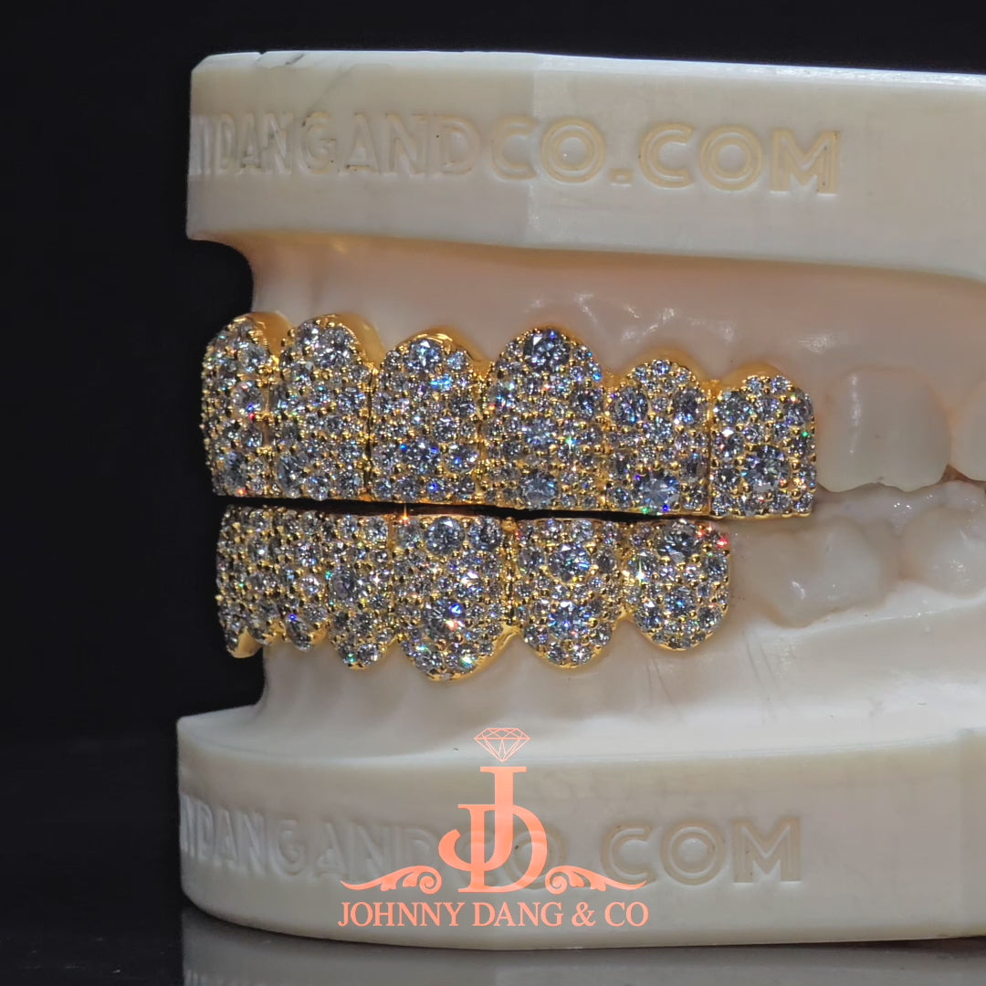 Flawless Mosaic Set Grillz Yellow Gold (Pull Out) ✅