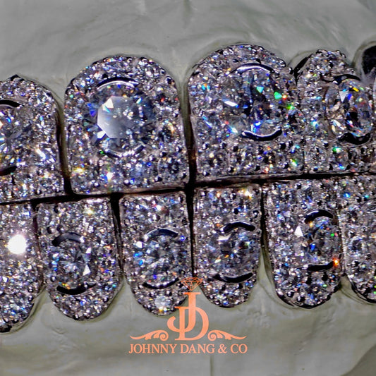 GIA "Honeymoon" Set Grillz White Gold (Perms)