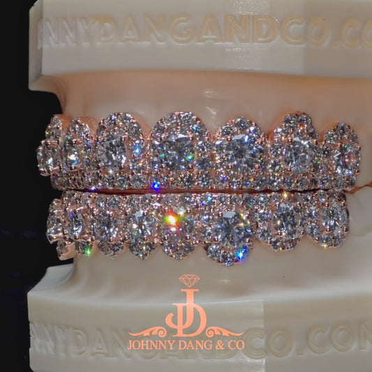 GIA "Honeymoon" Set Grillz Rose Gold (Pull Out) ✅